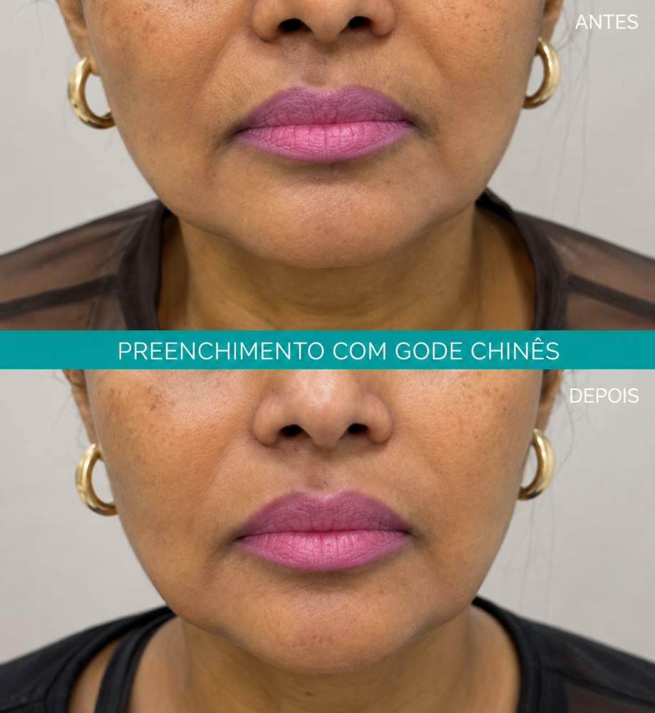 Bigode Chinês