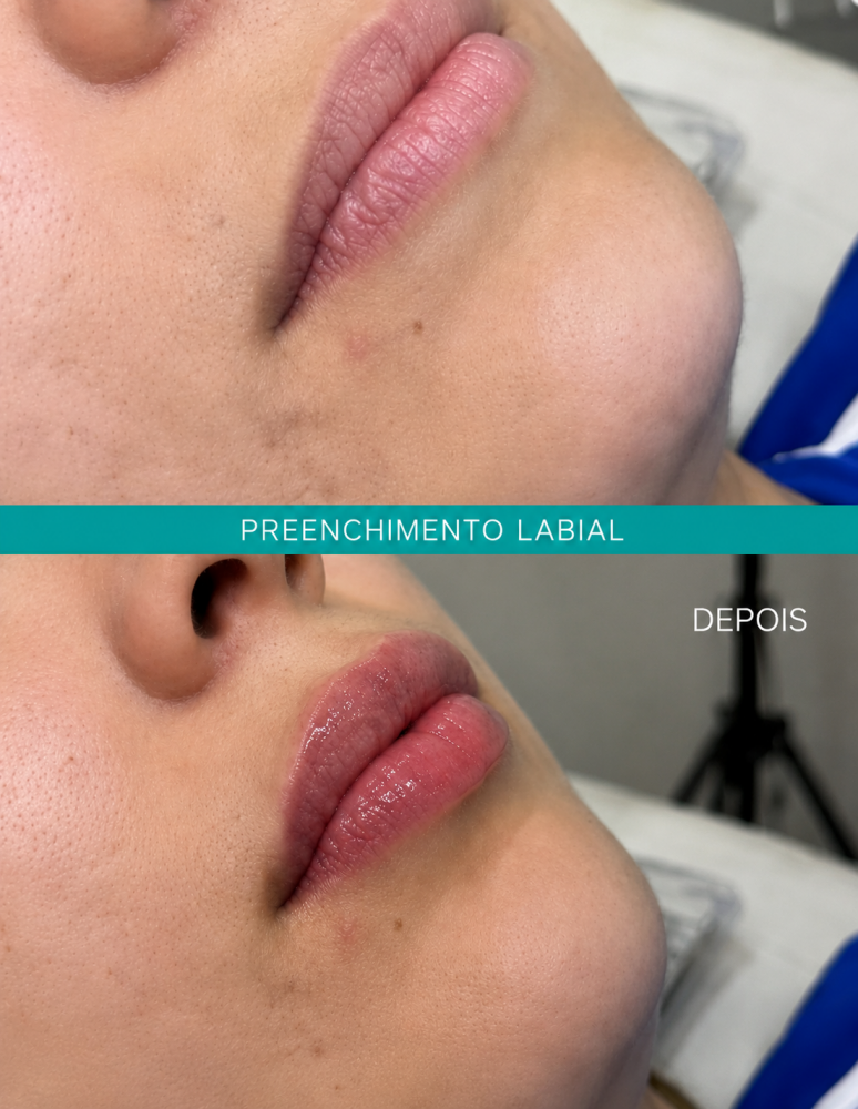 Labial